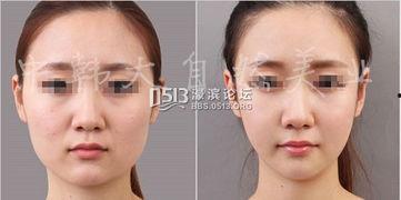 日本整骨男专家